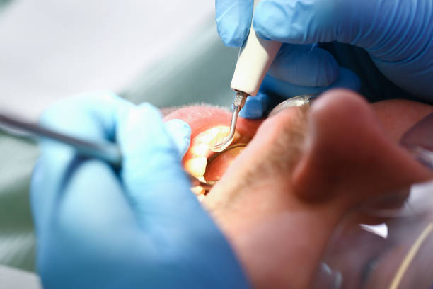 Best Tooth Pain Emergency Relief  in Piedmont, CA