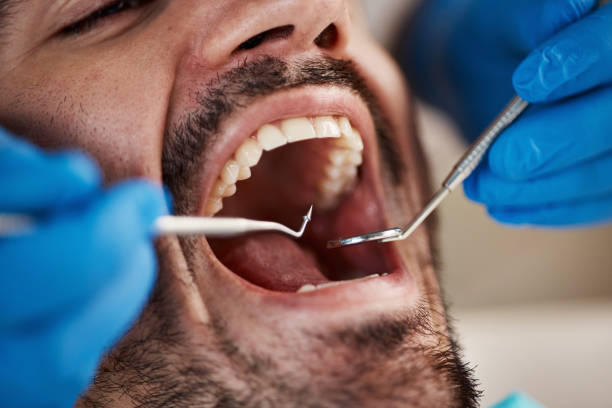 Best Tooth Infection Emergency Dentist  in Piedmont, CA
